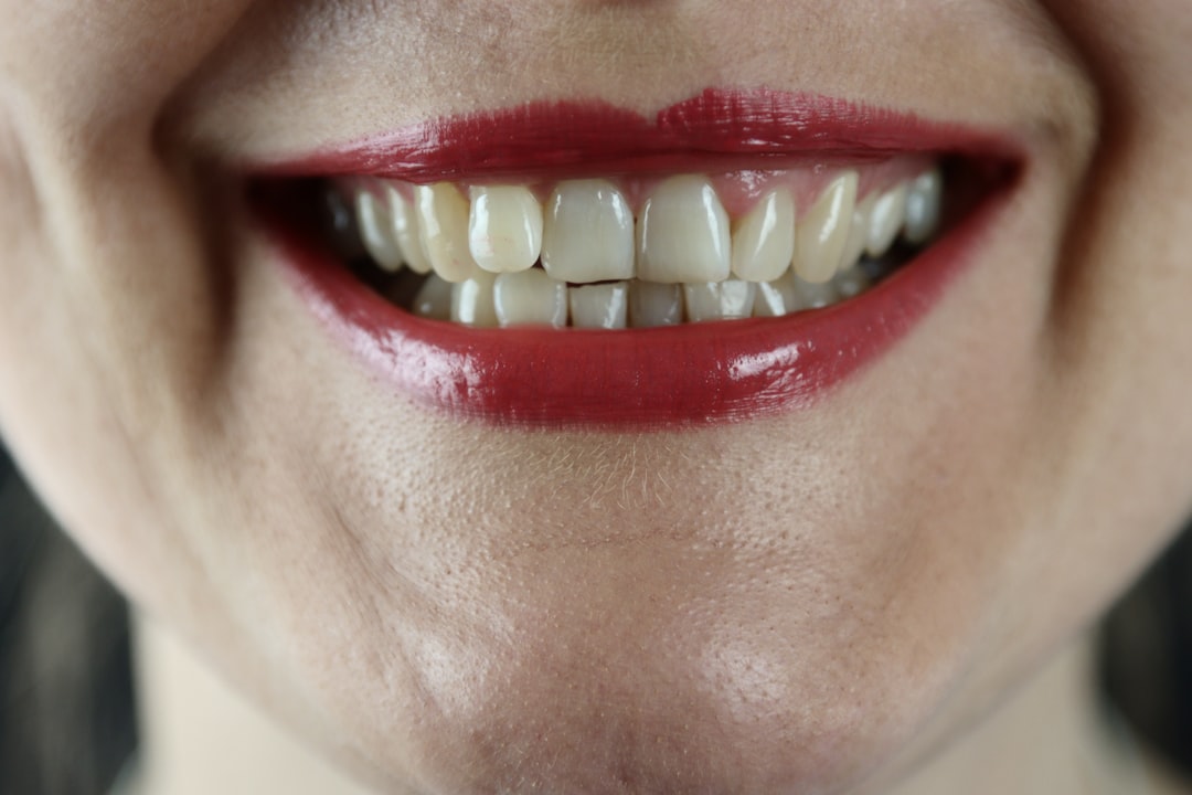 Close-up of a person's mouth offering a softer smile, showing some crooked teeth and wearing bright red lipstick.